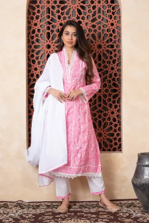Neckline Lace Printed